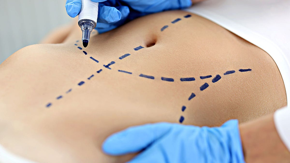 The main cosmetic procedures revealed in a new report: what is the tendency and why