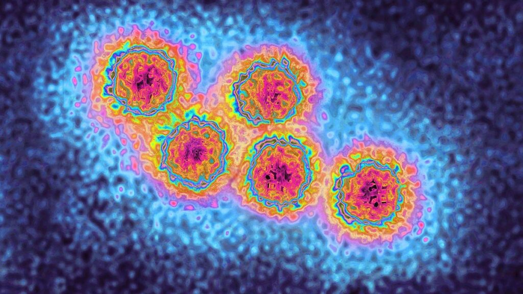The outburst of hepatitis to infect thousands of passengers to popular destinations